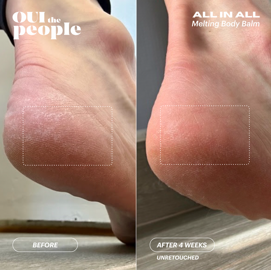 ALL IN ALL Melting Body Balm Before & After | OUI The People