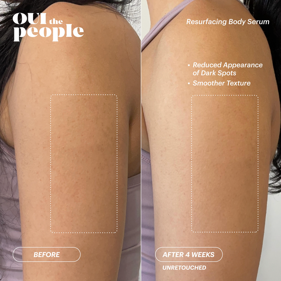 Resurfacing Body Serum Before & After | OUI The People