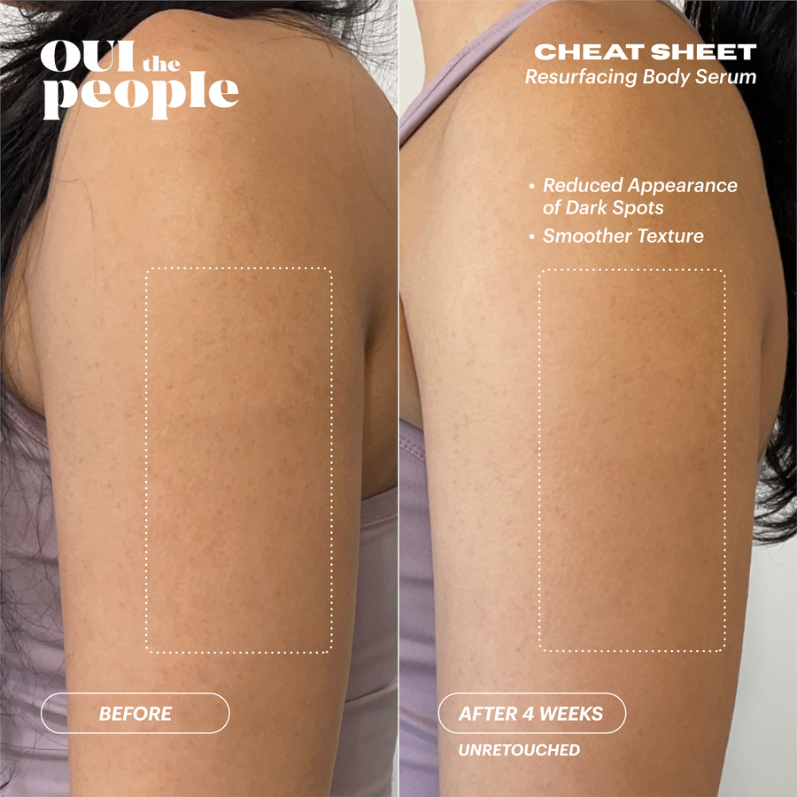 CHEAT SHEET Resurfacing Body Serum before & after | Oui the People